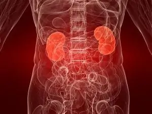 Sick kidneys